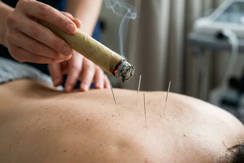 Moxibustion treatment at J.P. Hou Institute Orlando & Altamonte Springs