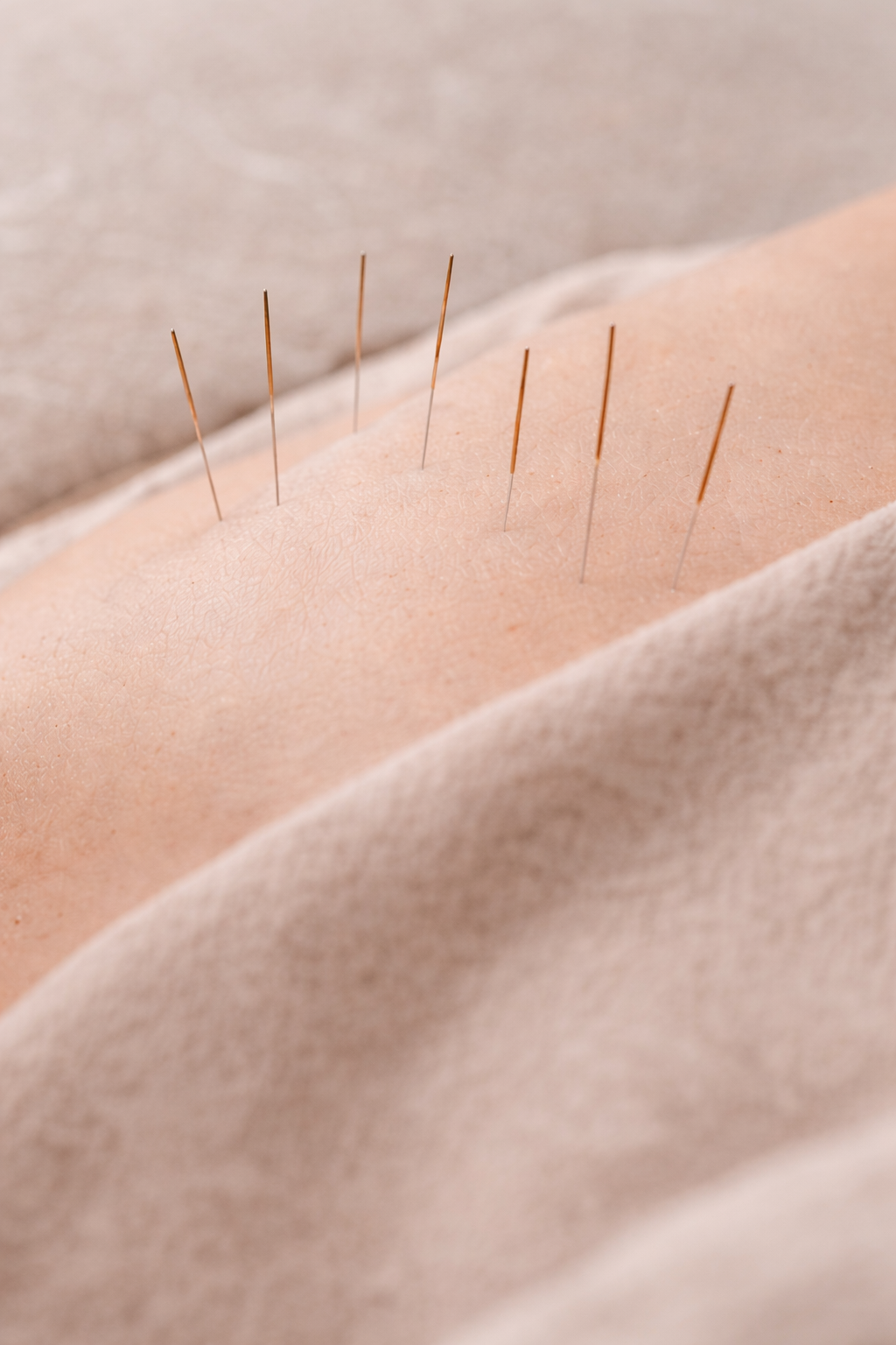 Acupuncture therapy at J.P. Hou Institute Orlando & Altamonte Springs