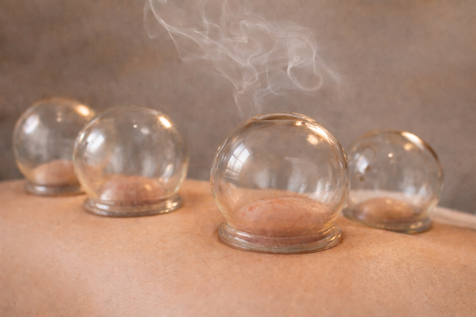 Cupping therapy at J.P. Hou Institute Orlando & Altamonte Springs