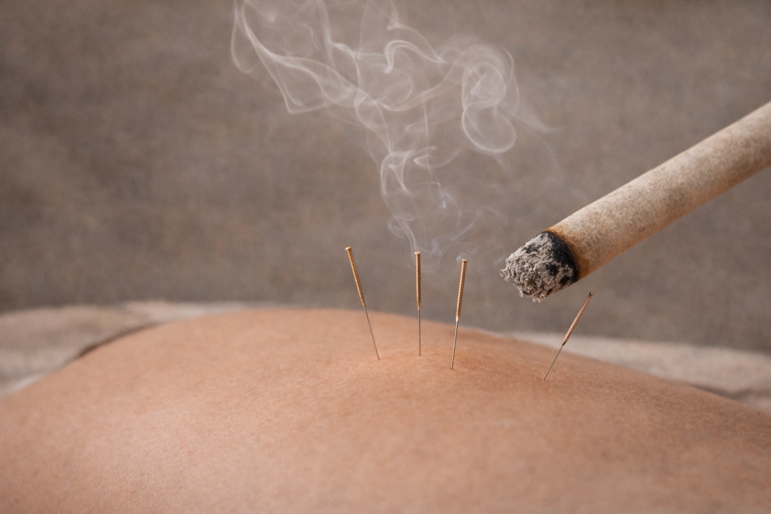 Moxibustion treatment at J.P. Hou Institute Orlando & Altamonte Springs